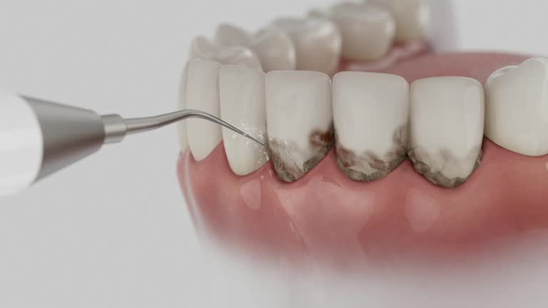 Reliable Dental contractor in Griggsville, IL by Dentist Open Now